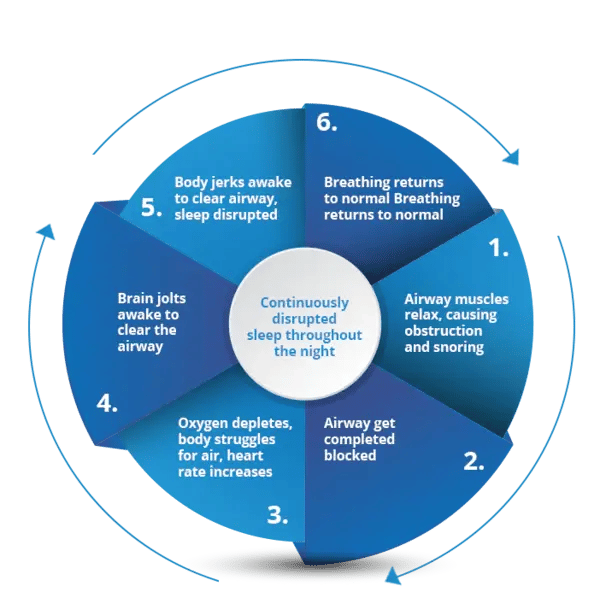 obstructive-sleep-apnea-1.