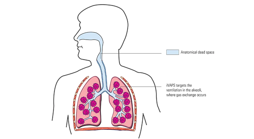 The importance of targeting alveolar ventilation
