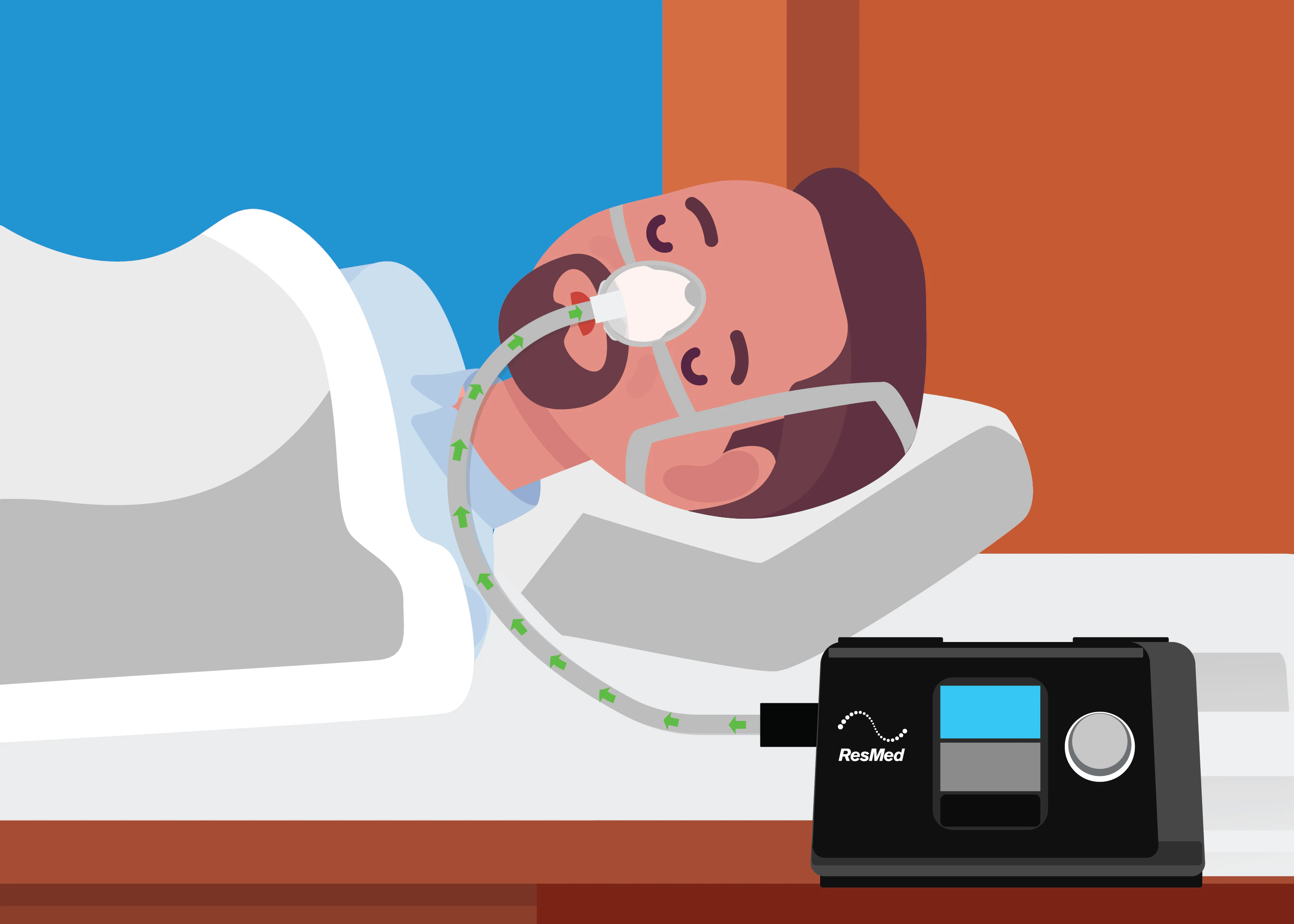 CPAP Pressure Settings