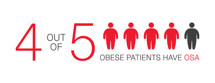 4 out of 5 obese patients have obstructive sleep apnea